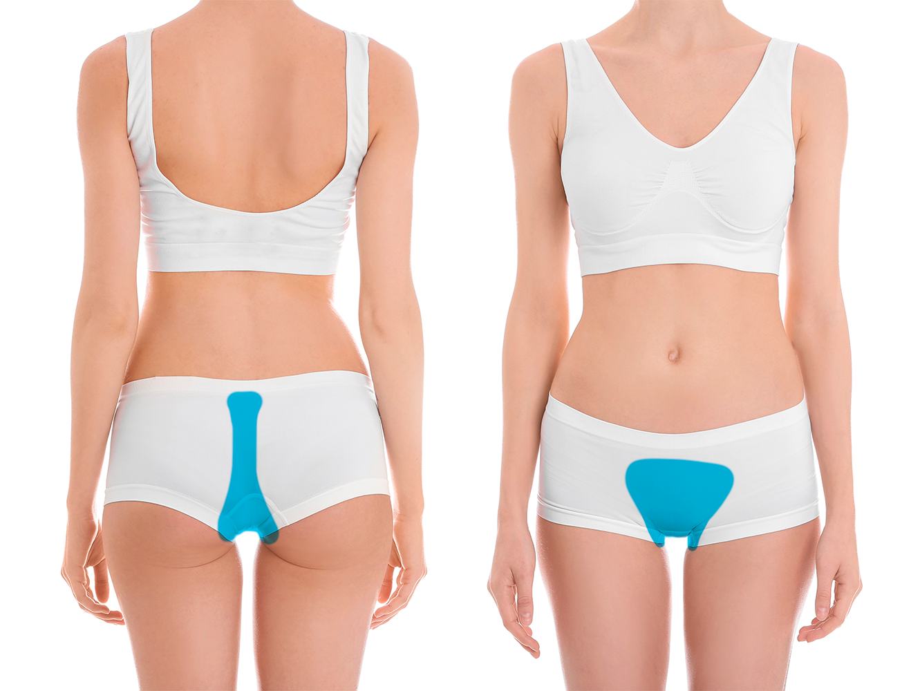 Zona intergluteo y full brazilian